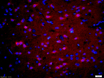 GnRHR Rabbit Polyclonal Antibody