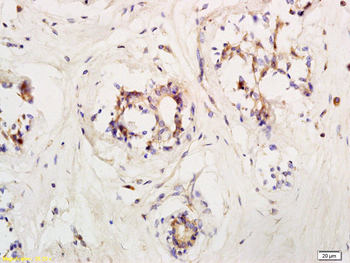 LIFR Rabbit Polyclonal Antibody