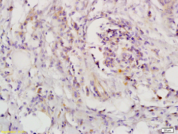LIFR Rabbit Polyclonal Antibody