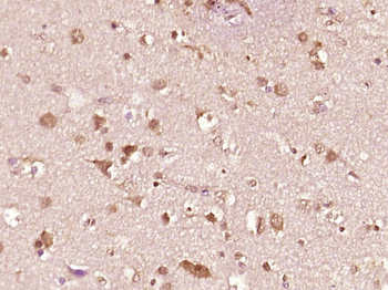 MAGE-1 Rabbit Polyclonal Antibody