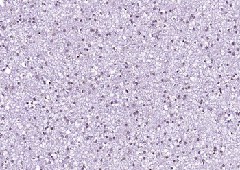 MEF2A Rabbit Polyclonal Antibody