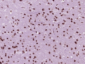 MEF2A Rabbit Polyclonal Antibody
