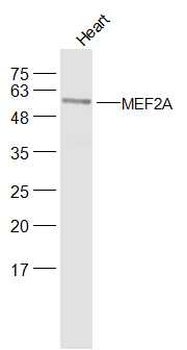 MEF2A Rabbit Polyclonal Antibody