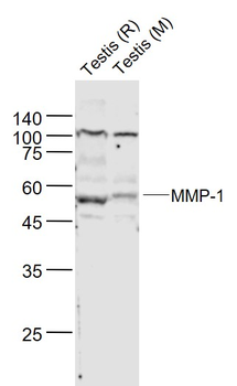 MMP1 Rabbit pAb