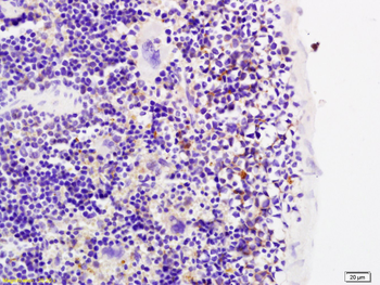 MMP-20 Rabbit Polyclonal Antibody