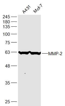 MMP2 Rabbit Polyclonal Antibody