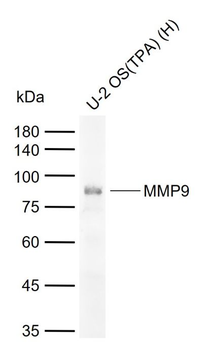 MMP9 Rabbit pAb