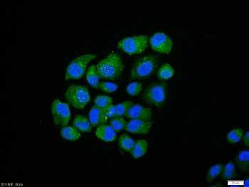 NFKB p65 Rabbit Polyclonal Antibody