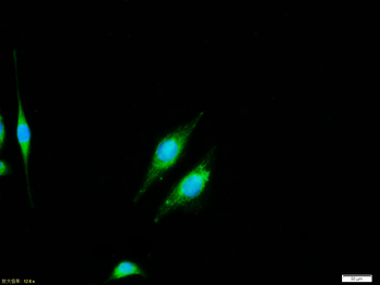 NFKB p65 Rabbit Polyclonal Antibody