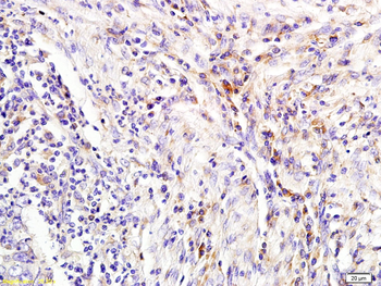 Lipocalin 2/NGAL Rabbit Polyclonal Antibody