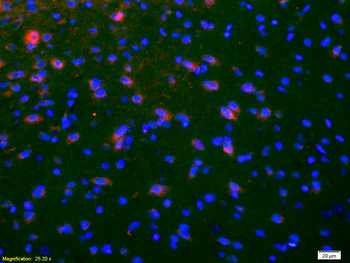 NKB Rabbit Polyclonal Antibody