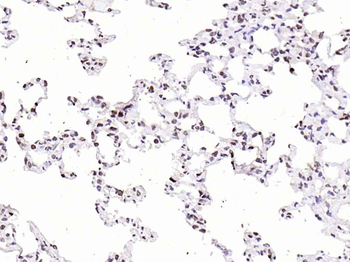 CDKN1A/p21 Rabbit Polyclonal Antibody