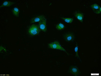 CDKN1A/p21 Rabbit Polyclonal Antibody