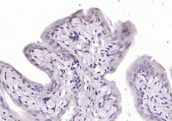 P53 protein (wt-p53) Rabbit Polyclonal Antibody