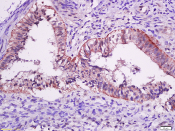 Mutant p53 (N235K, N239Y) Rabbit Polyclonal Antibody