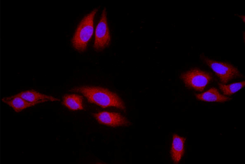 Mutant p53 (N235K, N239Y) Rabbit Polyclonal Antibody