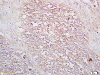 VIPR2 Rabbit Polyclonal Antibody