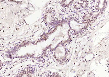 PADI4 Rabbit Polyclonal Antibody