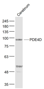 PDE4D Rabbit Polyclonal Antibody