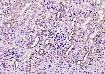 PEPT1 Rabbit Polyclonal Antibody