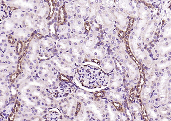 PEPT1 Rabbit Polyclonal Antibody
