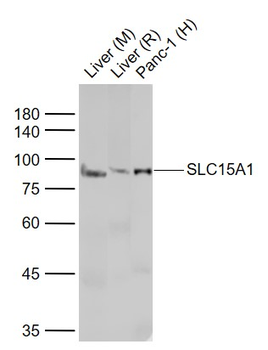 PEPT1 Rabbit Polyclonal Antibody