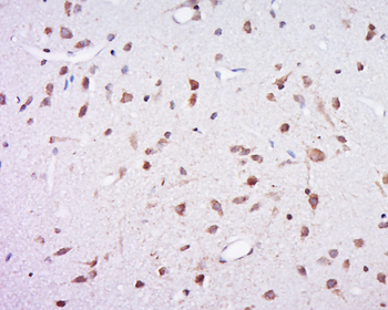 Profilin 1 Rabbit Polyclonal Antibody
