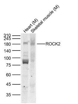 ROCK2 Rabbit Polyclonal Antibody