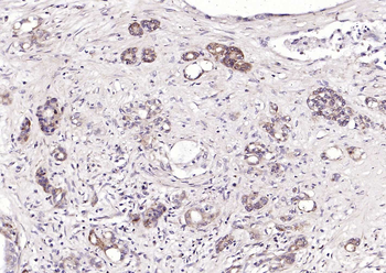 CRIM1 Rabbit Polyclonal Antibody