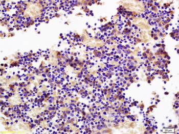 SOCS3 Rabbit Polyclonal Antibody