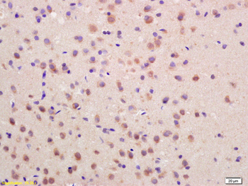 SOCS3 Rabbit Polyclonal Antibody