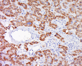 SOD1 Rabbit Polyclonal Antibody