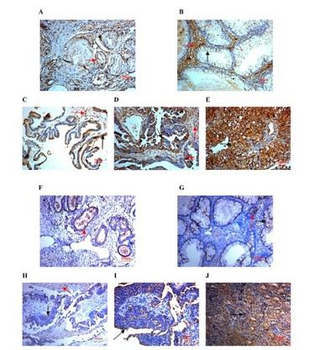 SPARC Rabbit Polyclonal Antibody