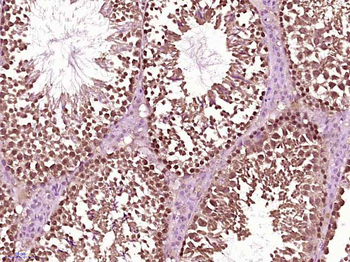 SRC Rabbit Polyclonal Antibody