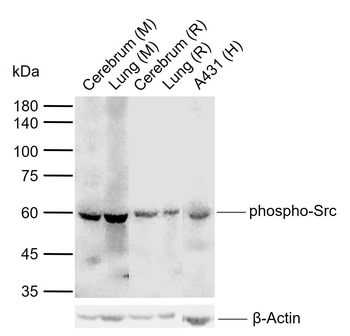 Phospho-Src (Tyr529) Rabbit Polyclonal Antibody