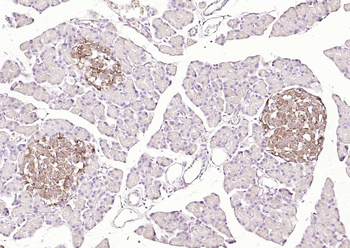 SYVN1 Rabbit Polyclonal Antibody