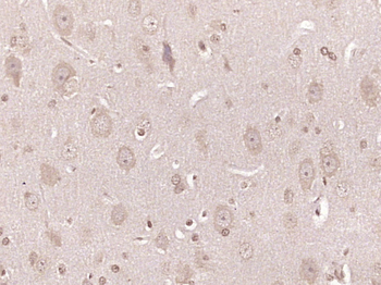 Gamma Synuclein Rabbit Polyclonal Antibody