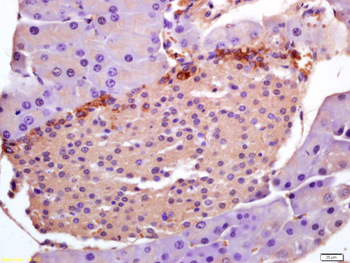 PHLDA1 Rabbit Polyclonal Antibody