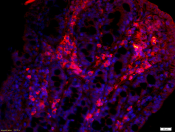 TIG2 Rabbit Polyclonal Antibody