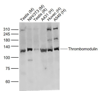 Thrombomodulin Rabbit Polyclonal Antibody