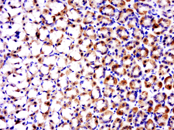 TRAF1 Rabbit Polyclonal Antibody
