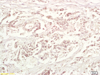 TRAF1 Rabbit Polyclonal Antibody