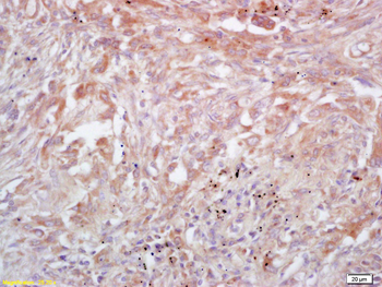 Trk A + B + C Rabbit Polyclonal Antibody