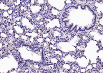 Cathepsin L Rabbit Polyclonal Antibody