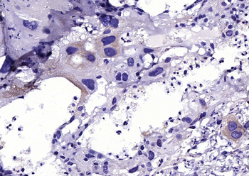 Cathepsin L Rabbit Polyclonal Antibody
