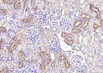 Cathepsin L Rabbit Polyclonal Antibody