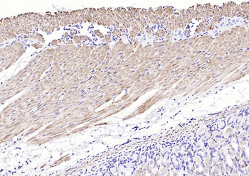 Desmin Recombinant Rabbit Monoclonal Antibody