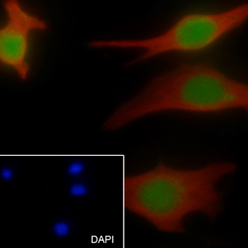 EZH2 Recombinant Rabbit Monoclonal Antibody