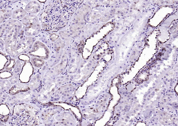 GSTP1 Recombinant Rabbit Monoclonal Antibody