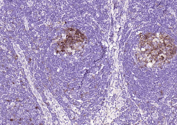 STMN1 Recombinant Rabbit Monoclonal Antibody